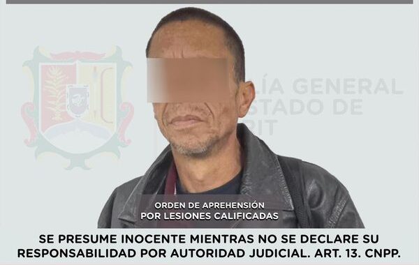 DETENIDO PRESUNTO RESPONSABLE DE LESIONES CALIFICADAS.