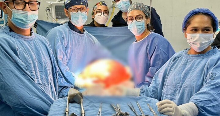 Retiran especialistas tumor de más de 13 kilogramos a paciente en Hospital Rural IMSS-Bienestar en San Cayetano.